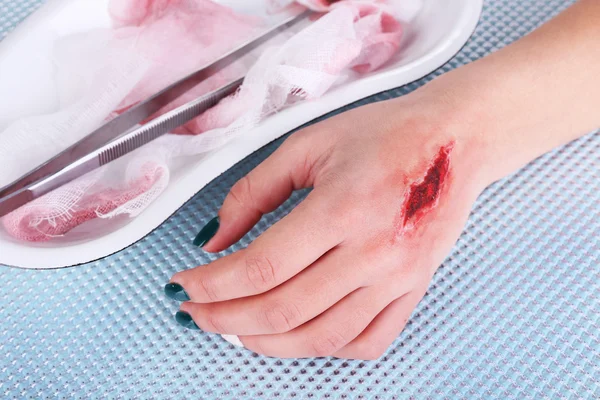 Injured hand with blood — Stock Photo, Image