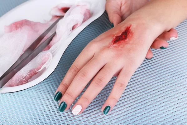 Verletzte Hand mit Blut — Stockfoto