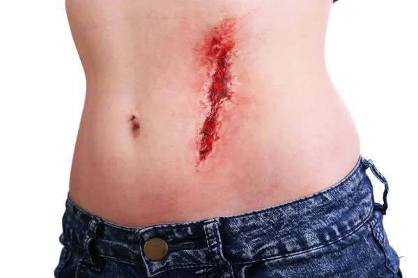 Verletzter Bauch mit Blut isoliert auf weiß — Stockfoto