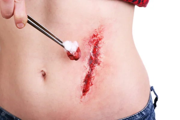 Verletzter Bauch mit Blut isoliert auf weiß — Stockfoto