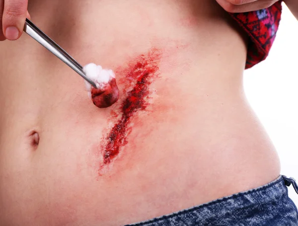 Abdomen lesionado con sangre aislada en blanco — Foto de Stock