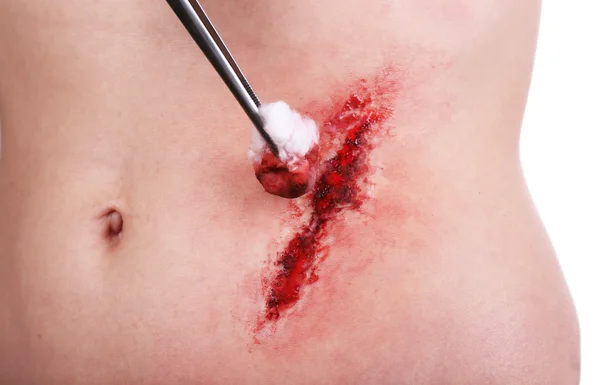 Abdomen lesionado con sangre aislada en blanco — Foto de Stock