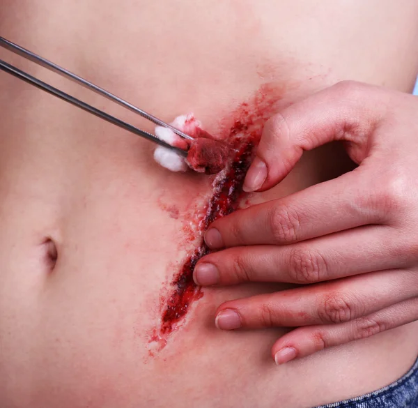 Injured abdomen with blood on blue background — Stock Photo, Image