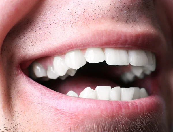 Glimlachende man na bezoek tandarts — Stockfoto