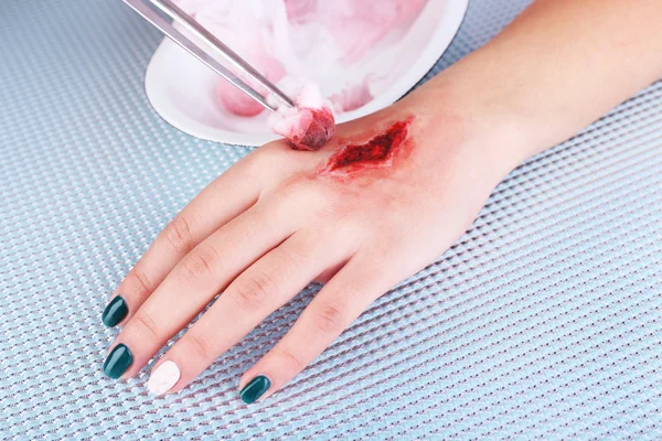 Mano lesionada con sangre en la mesa en el hospital — Foto de Stock
