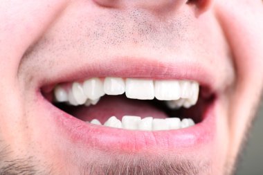 Adam ziyaret dişçi sonra gülümseyerek om bulanık arka plan, makro görünümü