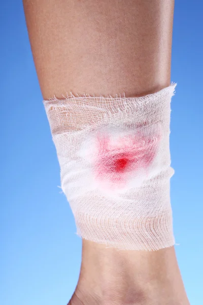 Wounded leg with bandage on blue background — Stock Photo, Image