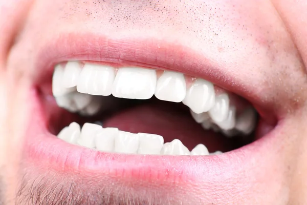 微笑的男人后访问牙医 om 模糊背景，宏观 — 图库照片