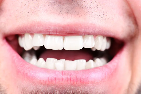 Lächelnder Mann nach Zahnarztbesuch mit verschwommenem Hintergrund, Makroansicht — Stockfoto