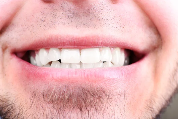 Улыбающийся человек после посещения стоматолога om расплывчатый фон, макровид — стоковое фото