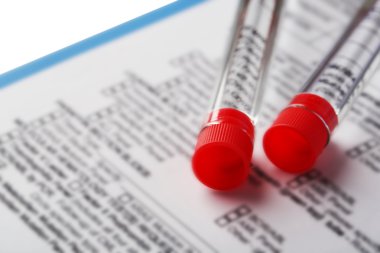 Test tüpleri ve Pano ile tıbbi geçmişi formu kapat