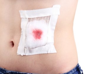 Yaralı karın üzerinde beyaz izole yapışkanlı bandaj ile