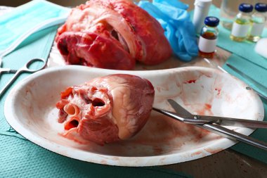 Kalp organ içinde tıbbi metal tepsi