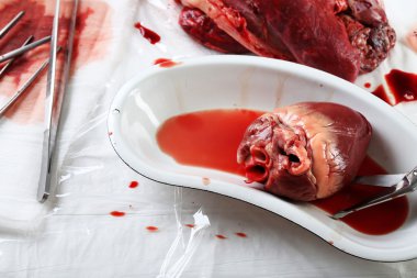 Kalp organ içinde tıbbi metal tepsi