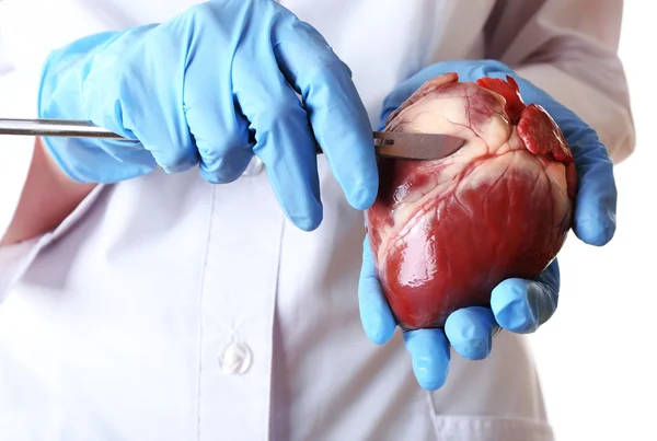 Medico in possesso di organo cardiaco e bisturi da vicino — Foto Stock