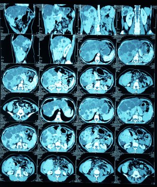 X-Ray tarayıcı üzerinde beyaz izole iç organlar