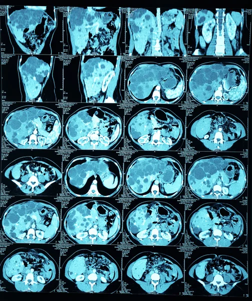 X-Ray tarayıcı üzerinde beyaz izole iç organlar — Stok fotoğraf