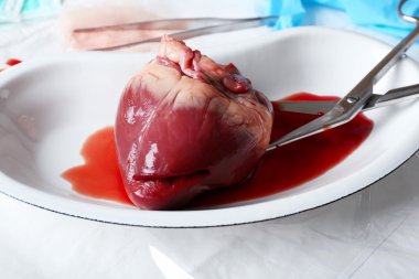 Kalp organ içinde tıbbi metal tepsi