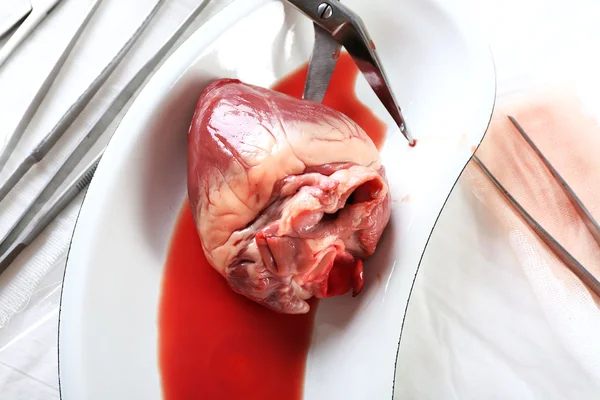 Heart organ in medical metal tray — Stock Photo, Image