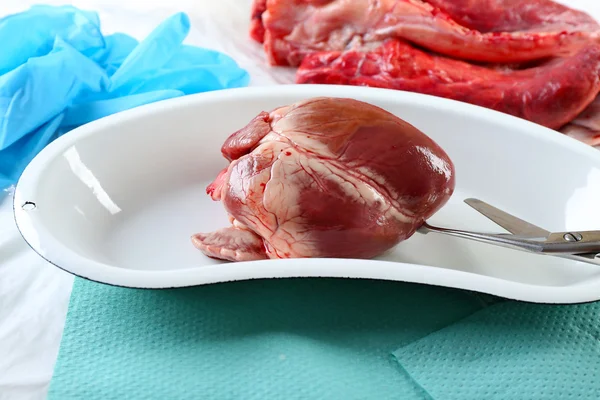 Heart organ in medical metal tray with tools on table close up — Stock Photo, Image