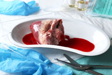 kalp organ masada tıbbi metal tepsisinde yakın çekim