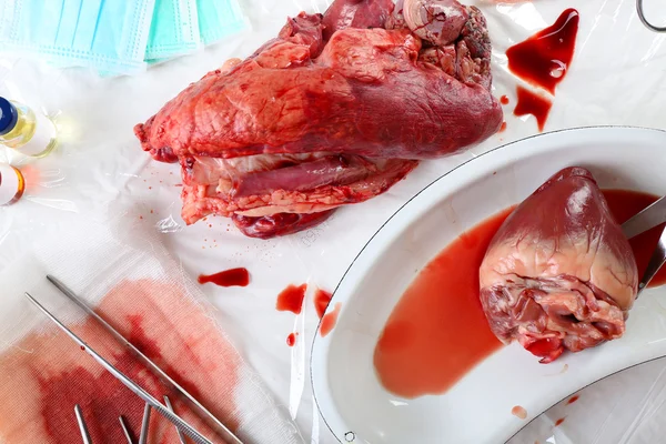 Órgão cardíaco em bandeja metálica médica com ferramentas — Fotografia de Stock
