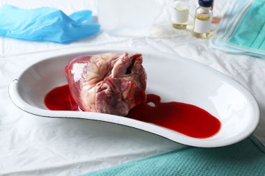 Kalp organ içinde tıbbi metal tepsi