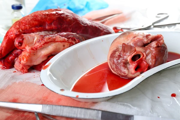 Órgão cardíaco em bandeja metálica médica — Fotografia de Stock