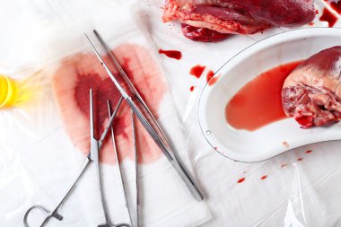 Tablo Araçları ile tıbbi metal tepsi kalp organ yakın çekim