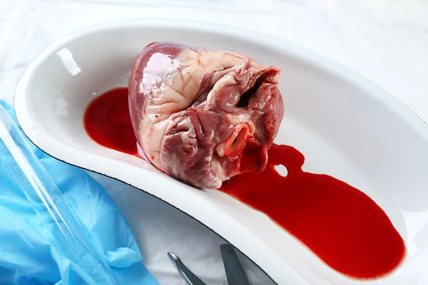 Organo cardiaco in vassoio metallico medico sul tavolo da vicino — Foto Stock