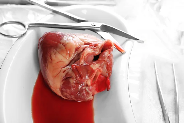 Heart organ in medical metal tray with tools on table close up — Stock Photo, Image