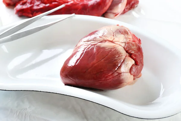 Heart organ in medical metal tray with tools — Stock Photo, Image