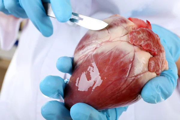 Doctor holding heart organ and scalpel close up — Stock Photo, Image