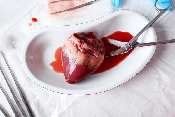 Órgão cardíaco em bandeja de metal médico com ferramentas na mesa de perto — Fotografia de Stock