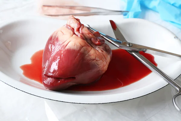 Heart organ in medical metal tray with tools on table close up — Stock Photo, Image