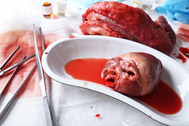 kalp organ araçları ile tıbbi metal tepsisinde