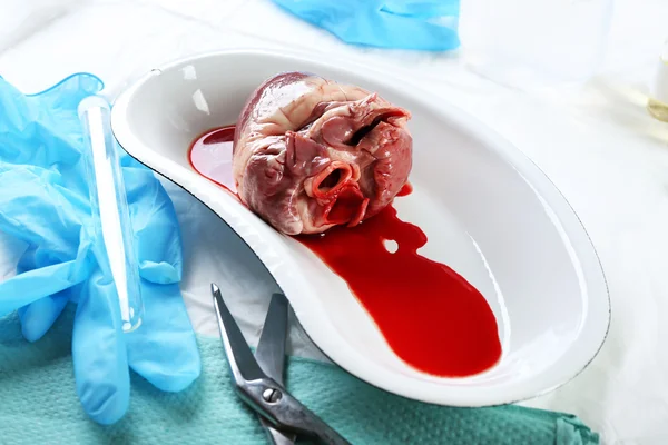 Órgano cardíaco en bandeja de metal médico en la mesa de cerca — Foto de Stock