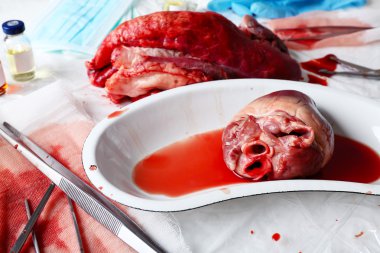 Tablo Araçları ile tıbbi metal tepsi kalp organ yakın çekim