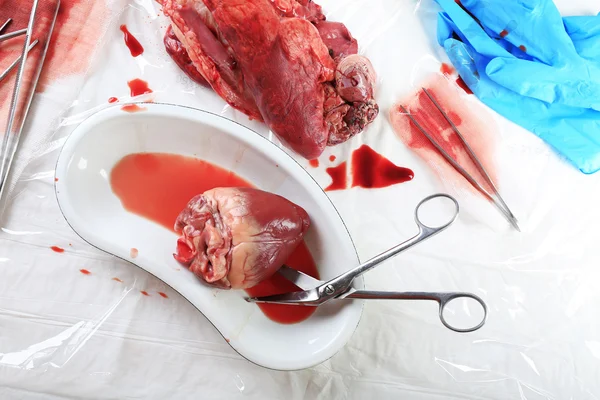 テーブル上のツールと金属製のトレイを医療で心臓器官をクローズ アップ — ストック写真