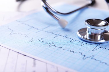 Masada steteskoplu kardiyogram, yakın plan.