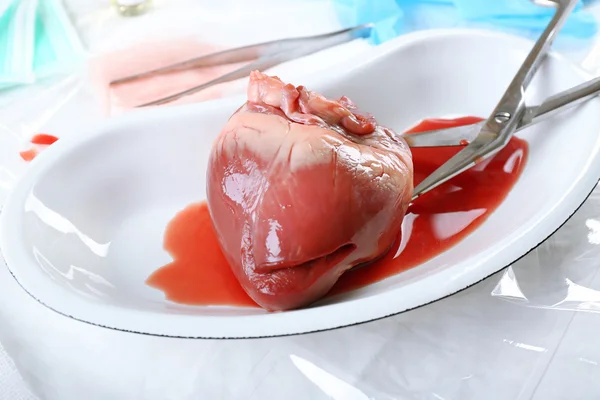 Heart organ in medical metal tray with tools on table close up — Stock Photo, Image