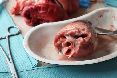 kalp organ içinde tablo, closeup araçlarıyla tıbbi metal tepsi