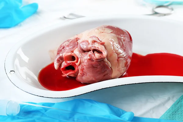 Kalp organ içinde tıbbi metal tepsi — Stok fotoğraf