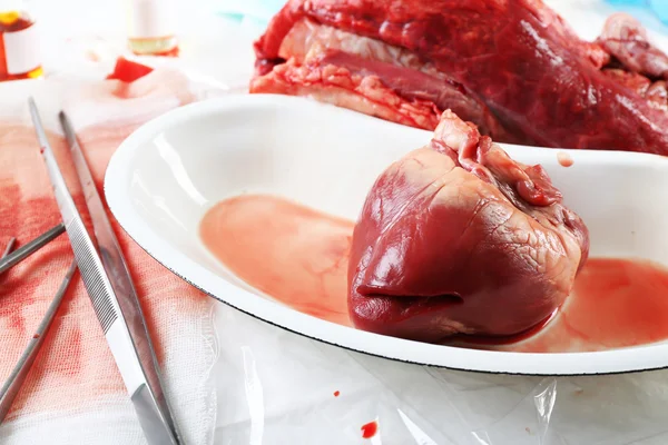 Heart organ in medical metal tray — Stock Photo, Image