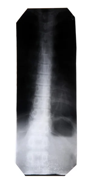 Рентгеновское изображение изолировано — стоковое фото