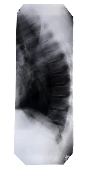 X-Ray image isolated — Stock Photo, Image