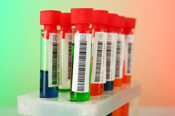 Test tüpleri açık renk arka plan üzerinde renkli sıvı ile — Stok fotoğraf