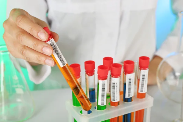 Test tubes with colorful liquid in scientist hand, closeup — Stock Photo, Image