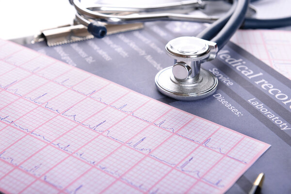 Stethoscope on cardiogram  sheet