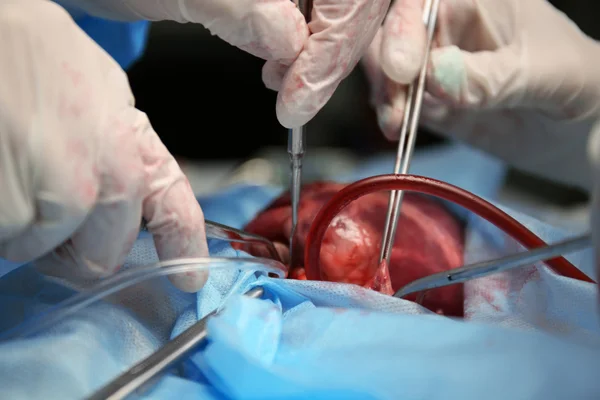 Врач делает операцию на сердце — стоковое фото